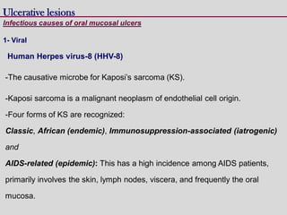 Human Herpes virus-8 (HHV-8)
-The causative microbe for Kaposi’s sarcoma (KS).
-Kaposi sarcoma is a malignant neoplasm of endothelial cell origin.
-Four forms of KS are recognized:
Classic, African (endemic), Immunosuppression-associated (iatrogenic)
and
AIDS-related (epidemic): This has a high incidence among AIDS patients,
primarily involves the skin, lymph nodes, viscera, and frequently the oral
mucosa.
Ulcerative lesions
Infectious causes of oral mucosal ulcers
1- Viral
 