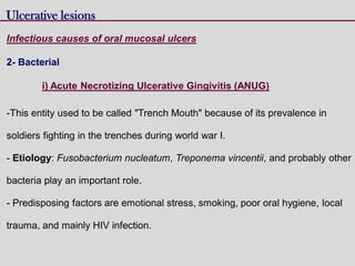 Ulcerative lesions
Infectious causes of oral mucosal ulcers
2- Bacterial
i) Acute Necrotizing Ulcerative Gingivitis (ANUG)
-This entity used to be called "Trench Mouth" because of its prevalence in
soldiers fighting in the trenches during world war I.
- Etiology: Fusobacterium nucleatum, Treponema vincentii, and probably other
bacteria play an important role.
- Predisposing factors are emotional stress, smoking, poor oral hygiene, local
trauma, and mainly HIV infection.
 