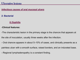 Ulcerative lesions
Infectious causes of oral mucosal ulcers
2- Bacterial
ii) Syphilis
-Clinical features:
-The characteristic lesion in the primary stage is the chancre that appears at
the site of inoculation, usually three weeks after the infection.
- Oral chancre appears in about 5–10% of cases, and clinically presents as a
painless ulcer with a smooth surface, raised borders, and an indurated base.
- Regional lymphadenopathy is a constant finding.
 