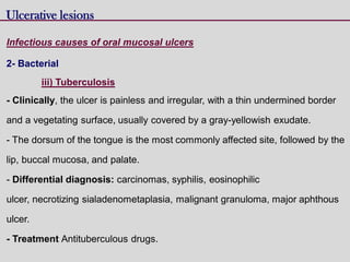 Ulcerative lesions
Infectious causes of oral mucosal ulcers
2- Bacterial
iii) Tuberculosis
- Clinically, the ulcer is painless and irregular, with a thin undermined border
and a vegetating surface, usually covered by a gray-yellowish exudate.
- The dorsum of the tongue is the most commonly affected site, followed by the
lip, buccal mucosa, and palate.
- Differential diagnosis: carcinomas, syphilis, eosinophilic
ulcer, necrotizing sialadenometaplasia, malignant granuloma, major aphthous
ulcer.
- Treatment Antituberculous drugs.
 