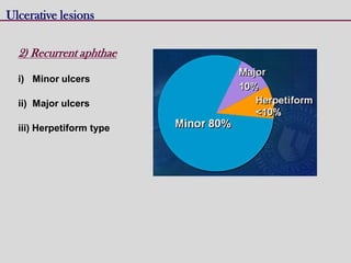 Ulcerative lesions
2) Recurrent aphthae
i) Minor ulcers
ii) Major ulcers
iii) Herpetiform type
 