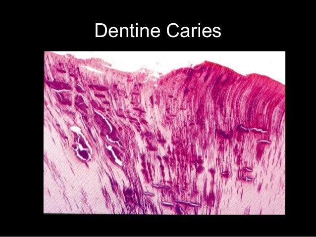 Oral pathologyy revision