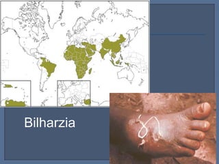 Bilharzia