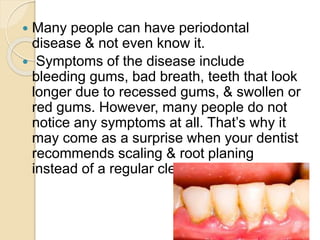  Many people can have periodontal
disease & not even know it.
 Symptoms of the disease include
bleeding gums, bad breath, teeth that look
longer due to recessed gums, & swollen or
red gums. However, many people do not
notice any symptoms at all. That’s why it
may come as a surprise when your dentist
recommends scaling & root planing
instead of a regular cleaning.
 