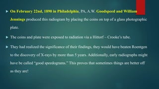  On February 22nd, 1890 in Philadelphia, PA, A.W. Goodspeed and William
Jennings produced this radiogram by placing the coins on top of a glass photographic
plate.
 The coins and plate were exposed to radiation via a Hittorf – Crooke’s tube.
 They had realized the significance of their findings, they would have beaten Roentgen
to the discovery of X-rays by more than 5 years. Additionally, early radiographs might
have be called “good speedograms.” This proves that sometimes things are better off
as they are!
 