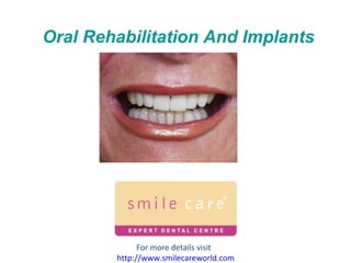 Oral Rehabilitation And Implants For more details visit  http://www.smilecareworld.com 