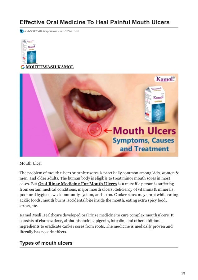 Effective Oral Rinse Medicine For Mouth Ulcers Treatment