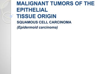 MALIGNANT TUMORS OF THE
EPITHELIAL
TISSUE ORIGIN
SQUAMOUS CELL CARCINOMA
(Epidermoid carcinoma)
 