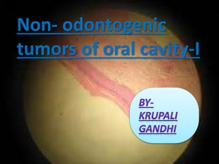 Non- odontogenic
tumors of oral cavity-I
 