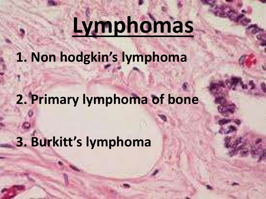 NON ODONTOGENIC TUMORS OF ORAL CAVITYI