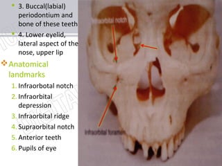 www.themegallery.com
 3. Buccal(labial)
periodontium and
bone of these teeth
 4. Lower eyelid,
lateral aspect of the
nose, upper lip
Anatomical
landmarks
1. Infraorbotal notch
2. Infraorbital
depression
3. Infraorbital ridge
4. Supraorbital notch
5. Anterior teeth
6. Pupils of eye
 