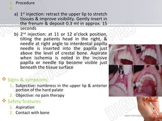 www.themegallery.com
3. Procedure
4.
a) 1st
injection: retract the upper lip to stretch
tissues & improve visibility. Gently insert in
the frenum & deposit 0.3 ml in approx. 15
seconds
b) 2nd
injection: at 11 or 12 o’clock position,
tilting the patients head in the right, &
needle at right angle to interdental papilla
needle is inserted into the papilla just
above the level of crestal bone. Aspirate
when ischemia is noted in the incisive
papilla or needle tip become visible just
beneath the tissue surface
 Signs & symptoms
1. Subjective: numbness in the upper lip & anterior
portion of the hard palate
2. Objective: no pain therapy
 Safety features
1. Aspiration
2. Contact with bone
 