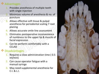 www.themegallery.com
 Advantages
1. Provides anesthesia of multiple teeth
with single injection
2. Minimizes volume of anesthesia & no. of
puncture
3. Allows effective soft tissue & pulpal
anesthesia for periodontal scaling 7 root
planing
4. Allows accurate smile line assessment
5. Eliminates postoperative inconvenience
of numbness to the upper lip & muscle of
facial expression
6. Can be perform comfortably with a
CCLAD
 Disadvantages
1. Requires a slow administration time ( 0.5
ml/min)
2. Can cause operator fatigue with a
manual syringe
3. May need supplemental anesthesia for
C.I. & L.I.
 