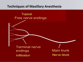 www.themegallery.com
Techniques of Maxillary Anesthesia
 