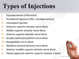 www.themegallery.com
Types of Injections
I. Supraperiosteal (infiltration)
II. Periodontal ligament (PDL, intraligamentary)
III. Intraseptal injection
IV. Posterior superior alveolar nerve block
V. Middle superior alveolar nerve block
VI. Anterior superior alveolar nerve block
VII. Greater (anterior) palatine nerve block
VIII. Nasopalatine nerve block
IX. Maxillary (second division) nerve block
X. Anterior meddle superior alveolar nerve block
XI. Palatal approach-anterior superior alveolar n block
 