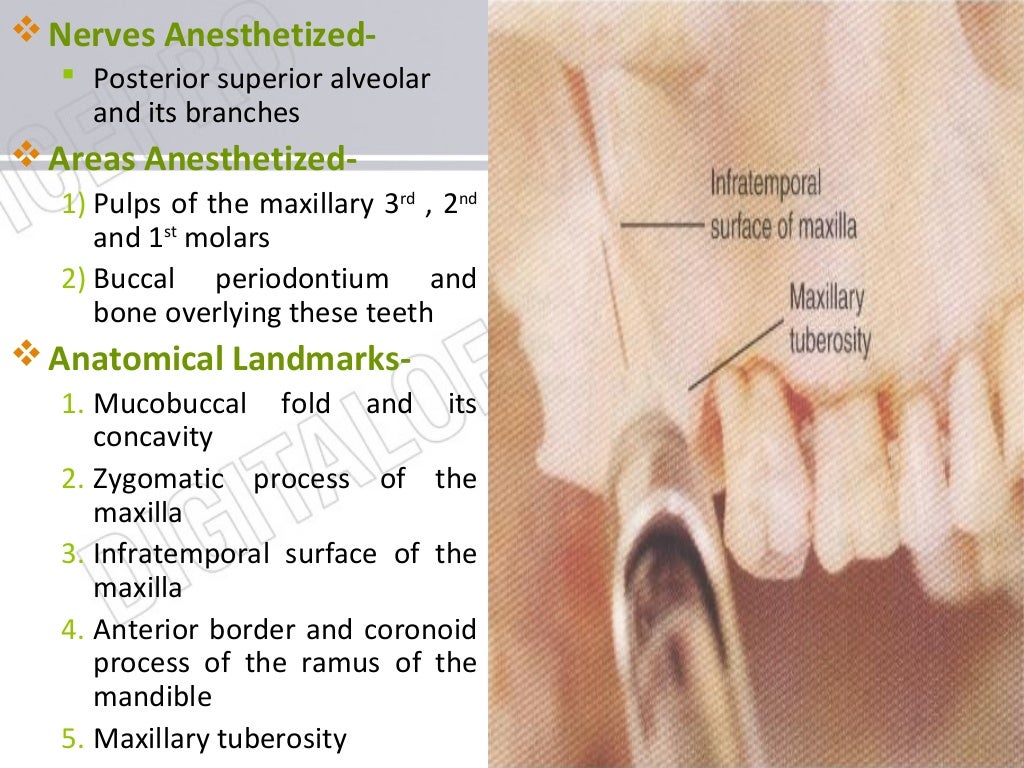 maxillary nerve blocks
