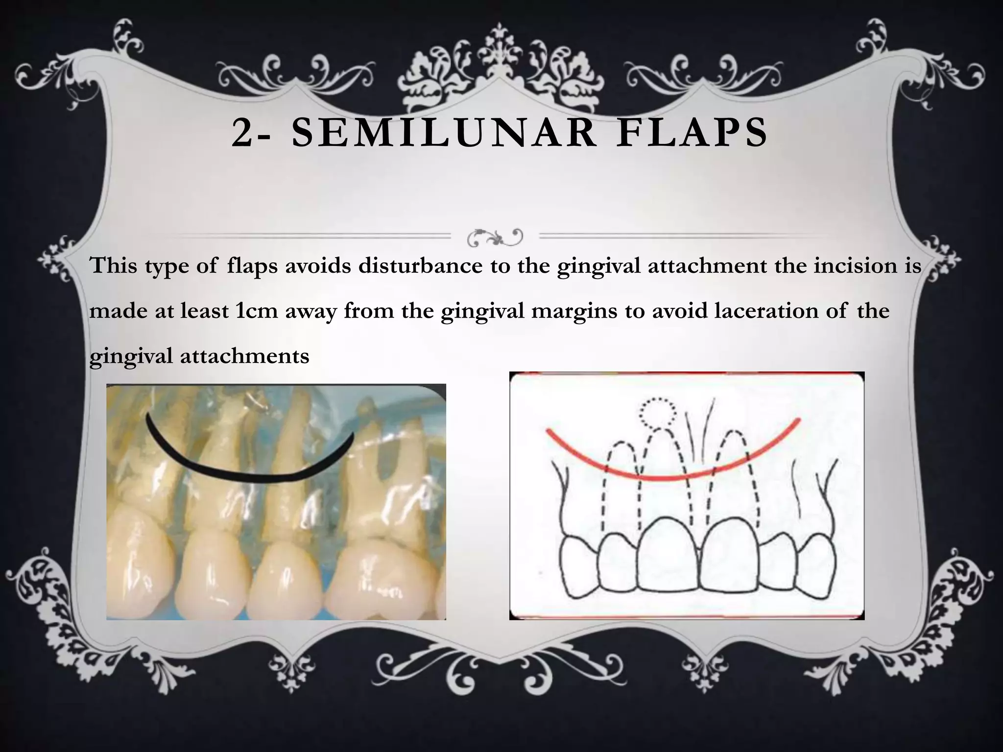Oral surgery principles | PPTX