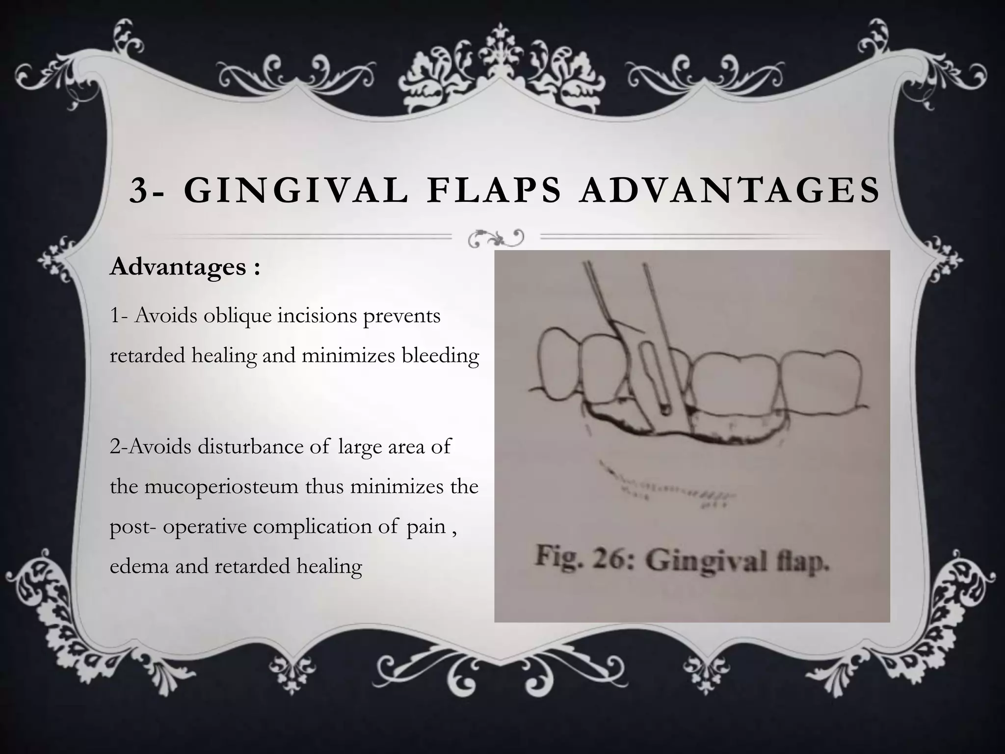 Oral surgery principles | PPTX