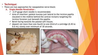 Np Injection oral surgery - techniques of local anesthesia powerpoint | PPTX