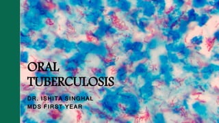 ORAL
TUBERCULOSIS
DR. ISHITA SINGHAL
MDS FIRST YEAR
 