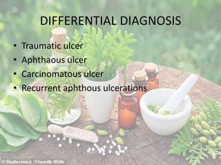 DIFFERENTIAL DIAGNOSIS
• Traumatic ulcer
• Aphthaous ulcer
• Carcinomatous ulcer
• Recurrent aphthous ulcerations
 