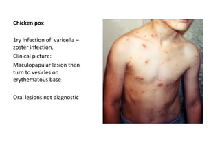 Chicken pox
1ry infection of varicella –
zoster infection.
Clinical picture:
Maculopapular lesion then
turn to vesicles on
erythematous base
Oral lesions not diagnostic

 