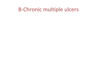 B-Chronic multiple ulcers

 