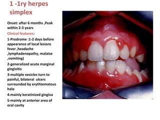 1 -1ry herpes
simplex
Onset: after 6 months ,Peak
within 2-3 years
Clinical features:
1-Prodrome :1-2 days before
appearance of local lesions
fever ,headache
,lymphadenopathy, malaise
,vomiting)
2-generalized acute marginal
gingivitis
3-multiple vesicles turn to
painful, bilateral ulcers
surrounded by erythtematous
halo
4-mainly keratinized gingiva
5-mainly at anterior area of
oral cavity

 