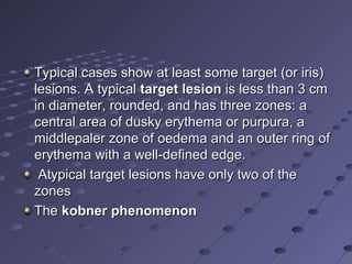 Typical cases show at least some target (or iris)
lesions. A typical target lesion is less than 3 cm
in diameter, rounded, and has three zones: a
central area of dusky erythema or purpura, a
middlepaler zone of oedema and an outer ring of
erythema with a well-defined edge.
Atypical target lesions have only two of the
zones
The kobner phenomenon

 