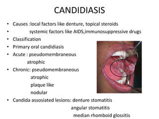 Oral White Lesions DR.Sandra.pptx