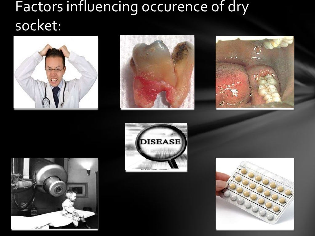 Oral wound healing, biopsy,exfoliative cytology