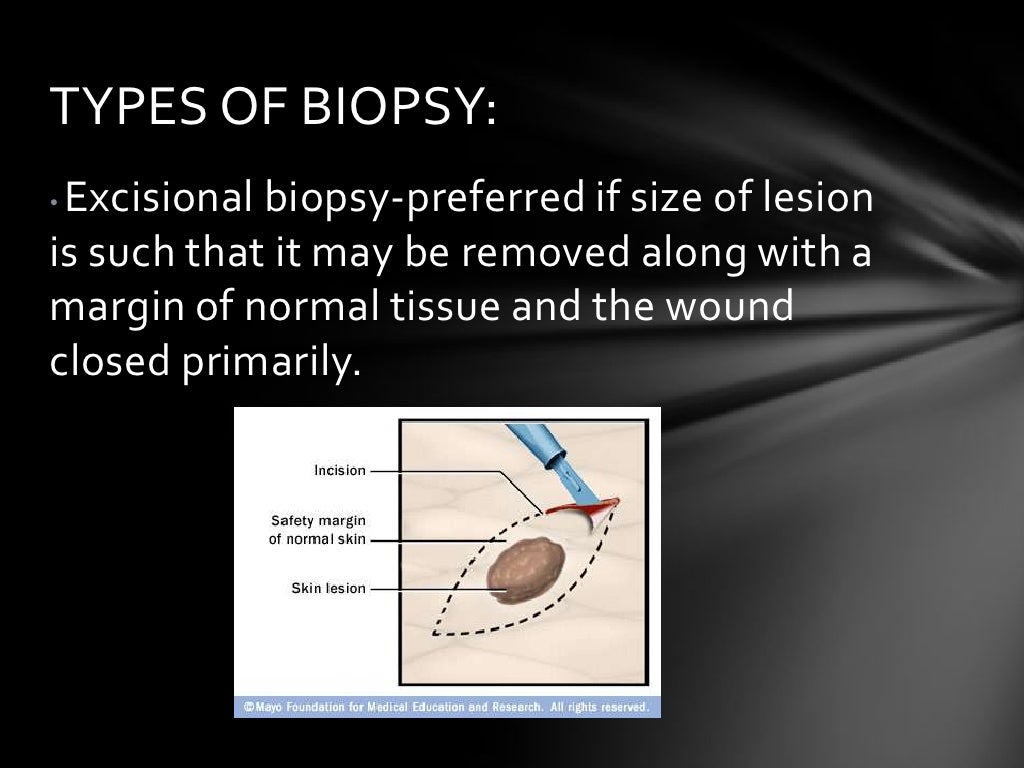 Oral wound healing, biopsy,exfoliative cytology