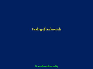 Healing of oral wounds
Dr.madhusudhanreddy
 