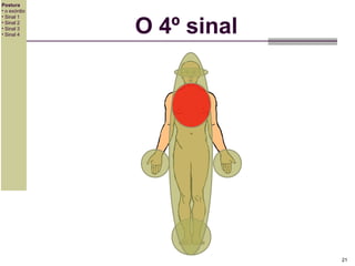 Postura
• o exórdio
• Sinal 1
• Sinal 2
• Sinal 3
• Sinal 4

O 4º sinal

21

 