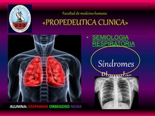 Facultad de medicina humana
«PROPEDEUTICA CLINICA»
• SEMIOLOGIA
RESPIRATORIA
Síndromes
Pleurales
ALUMNA: STEPHANIE ORBEGOSO NEIRA
 