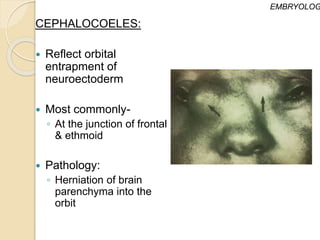 CEPHALOCOELES:
 Reflect orbital
entrapment of
neuroectoderm
 Most commonly-
◦ At the junction of frontal
& ethmoid
 Pathology:
◦ Herniation of brain
parenchyma into the
orbit
EMBRYOLOG
 