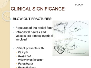 CLINICAL SIGNIFICANCE
 BLOW OUT FRACTURES:
◦ Fractures of the orbital floor
◦ Infraorbital nerves and
vessels are almost invariably
involved
◦ Patient presents with
 Diplopia
 Restricted
movements(upgaze)
 Paresthesia
FLOOR
 