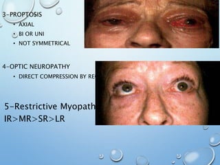 3-PROPTOSIS
• AXIAL
• BI OR UNI
• NOT SYMMETRICAL
4-OPTIC NEUROPATHY
• DIRECT COMPRESSION BY RECTI
5-Restrictive Myopathy
IR>MR>SR>LR
 