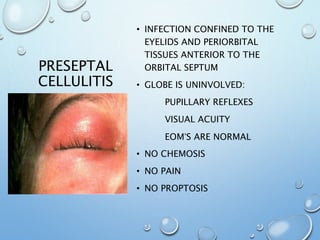 PRESEPTAL
CELLULITIS
• INFECTION CONFINED TO THE
EYELIDS AND PERIORBITAL
TISSUES ANTERIOR TO THE
ORBITAL SEPTUM
• GLOBE IS UNINVOLVED:
PUPILLARY REFLEXES
VISUAL ACUITY
EOM’S ARE NORMAL
• NO CHEMOSIS
• NO PAIN
• NO PROPTOSIS
 