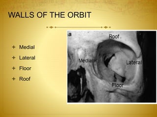 WALLS OF THE ORBIT
 Medial
 Lateral
 Floor
 Roof
 