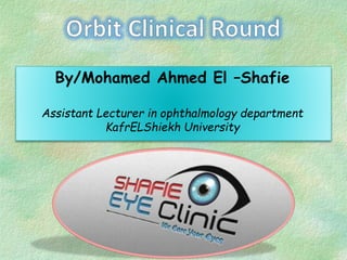 By/Mohamed Ahmed El –Shafie
Assistant Lecturer in ophthalmology department
KafrELShiekh University
 