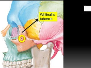 Whitnall’s
tubercle
 