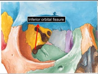 Inferior orbital fissure
 