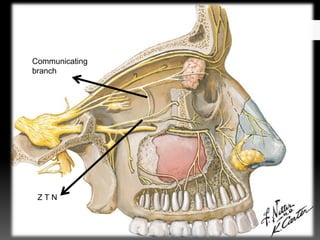 Communicating
branch
Z T N
 