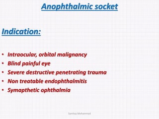 Anophthalmic socket
Indication:
• Intraocular, orbital malignancy
• Blind painful eye
• Severe destructive penetrating trauma
• Non treatable endophthalmitis
• Symapthetic ophthalmia
Samhaa Mohammed
 
