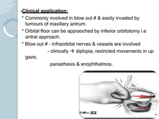 -Clinical application:
* Commonly involved in blow out # & easily invaded by
tumours of maxillary antrum.
* Orbital floor can be appraoched by inferior orbitotomy i.e
antral approach.
* Blow out # - Infraorbital nerves & vessels are involved
- clinically  diplopia, restricted movements in up
gaze,
parasthesis & enophthalmos.
 