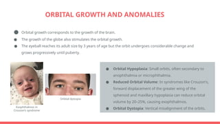 Comprehensive Anatomy and Developmental Changes of the Human Orbit | PPTX