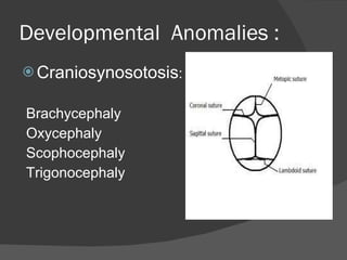 Developmental  Anomalies : Craniosynosotosis : Brachycephaly Oxycephaly Scophocephaly Trigonocephaly  