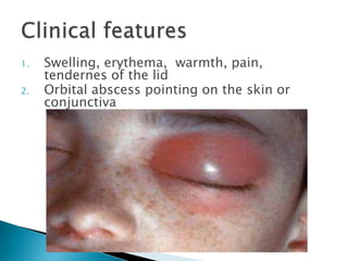 1. Swelling, erythema, warmth, pain, 
tendernes of the lid 
2. Orbital abscess pointing on the skin or 
conjunctiva 
 