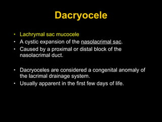 Dacryocele Lachrymal sac mucocele A cystic expansion of the  nasolacrimal sac .  Caused by a proximal or distal block of the nasolacrimal duct.  Dacryoceles are considered a congenital anomaly of the lacrimal drainage system. Usually apparent in the first few days of life.  